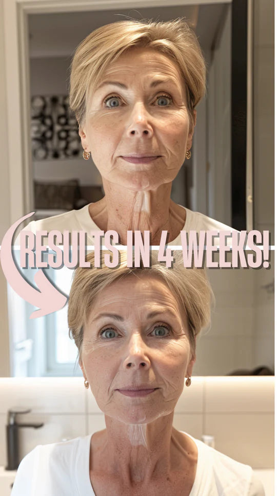 Facial Lifting Device